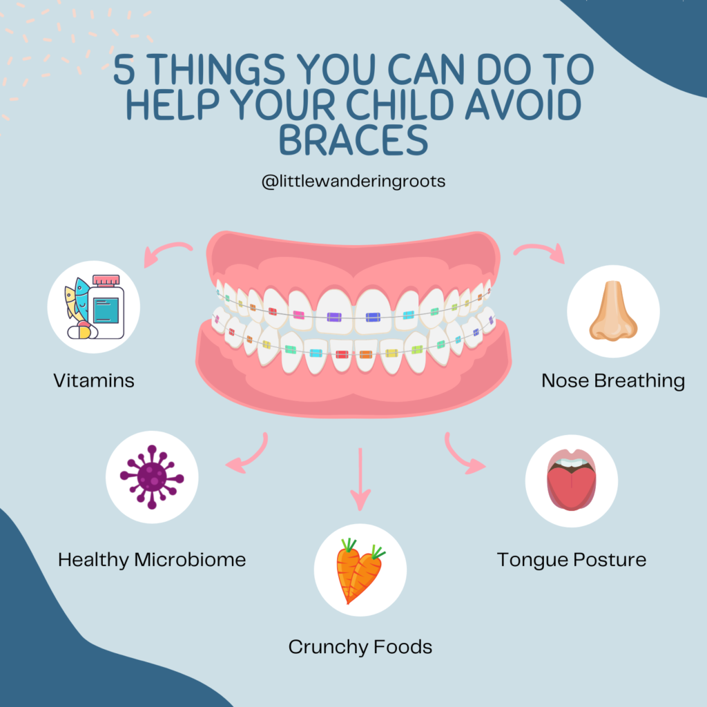 How to help your child avoid braces: 5 simple tips! - Little Wandering ...